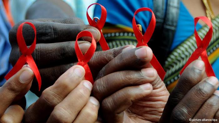 hiv aids